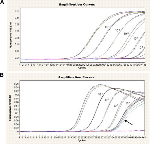 Figure 1. Limited dilution series for the assessment of sensitivity and specificity of NPM1 mutations. cDNA from time point of diagnosis was diluted in an NPM1-unmutated cDNA. (A) An example of a patient with NPM1 mutation of type A is shown. This mutant shows high specificity and sensitivity. (B) In type D, a coamplification of wild-type NPM1 was observed (indicated by ), leading to reduced sensitivity.