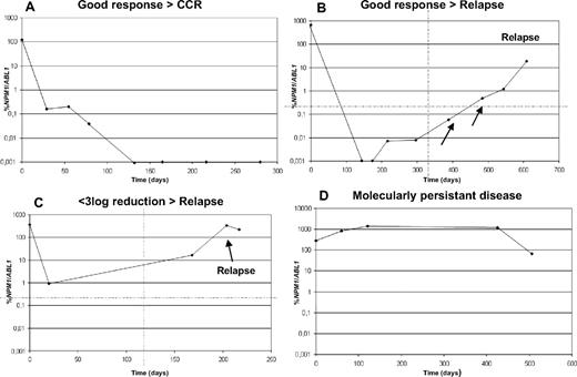 Figure 3. Four different response patterns defined according to the MRD values as assessed by RQ-PCR. Examples of individual patients are shown in panel A for good response, in panel B for good response and later relapse, which was detectable early as the result of increasing levels of the NPM1 mutation, in panel C for patients with less than 3-log reduction and relapse, and in panel D for patients with persistent disease. X-axis indicates time in days; y-axis indicates mutation level given as %NPM1/ABL1.