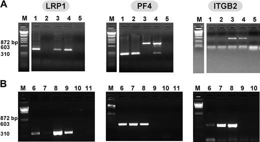 Figure 1. RT-PCR of human and murine megakaryocytes and platelets. (A) Murine RT-PCR studies of total RNA from (1) megakaryocyte, (2) platelets, (3) WBCs, (4) NIH-3T3 cells, known to express LRP1,20 and (5) water for LRP1 (first gel), PF4 (second gel), and ITGB2 (third gel). Expected band size is approximately 400 base pair (bp) for LRP1 and ITGB2, and approximately 300 bp for PF4. White space indicates where lanes were removed for ease of presentation. (B) Human RT-PCR studies of total RNA from (6) megakaryocytes, (7) platelets, (8) WBCs, (9) 293T cells, embryonic kidney line known to express LRP1,21 (10) water, and (11) no reverse transcriptase controls for LRP1 (first gel), PF4 (second gel), and ITGB2 (third gel).