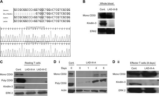Figure 1. Kindlin-3 is lost in LAD-III patients, whereas CDGI expression is restricted to primary leukocytes of a subset of LAD-III patients. (A) Multiple alignment of genomic DNA sequence (chr11:63735681-63735711, National Center for Biotechnology Information Build 36) surrounding the putative stop codon mutation within the Kindlin-3 gene. (B) Lysates of whole blood cells either derived from a control donor or from LAD-III-B patient were immunoblotted with anti–Kindlin-3 Ab, anti-CDGI mAb, or anti–total ERK2 antibody as a control. (C) Lysates of resting T cells from control, LAD-III-A, or LAD-III-C patients were immunoblotted with anti–Kindlin-3 antibody, anti-CDGI mAb (Mono), anti-CDGI antibody (Poly), and anti–total ERK2 Ab. (Di) Lysates of effector T cells derived from control and LAD-III-A patients after the indicated number of days of in vitro expansion were each immunoblotted with anti–Kindlin-3, anti-CDGI mAb, anti-CDGI polyclonal Ab, and anti-actin antibody as a control. (Dii) Lysates of control and LAD-III-A effector T cells derived after 8 days of expansion in vitro were immunoblotted with anti–Kindlin-3 Ab, anti-CDGI mAb, and anti–total ERK2 Ab, as in panel B.