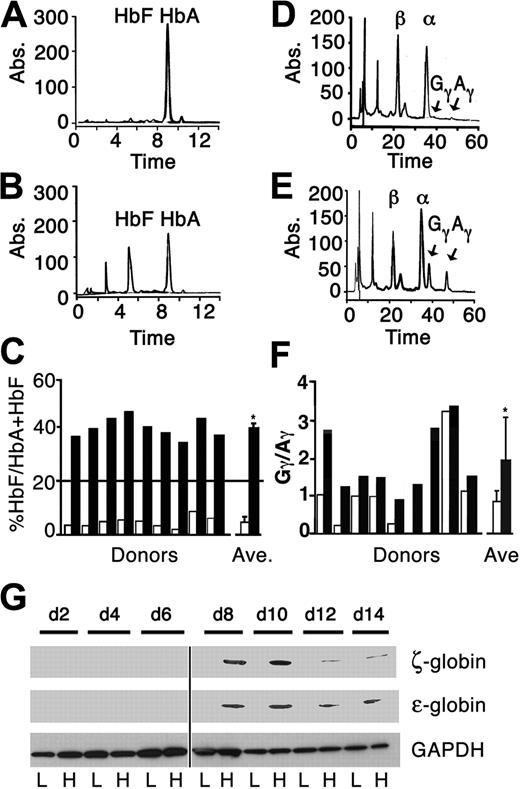 Figure 1. Determination of hemoglobin and globin chain expression. (A-C) Cation exchange and (D-F) reverse-phase chromatography analyses of cells cultured in (A,D) low-HbF versus (B,E) high-HbF culture conditions. The major peaks are labeled on each graph (y-axis, absorbance; x-axis, elution time). (C) The HbF/HbF + HbA ratios expressed as a percentage (y-axis) from 9 separate donor-matched erythroblasts cultured for 14 days in low-HbF (□) and high-HbF (■) conditions. Average values (Ave) are also shown. (F) Gγ/Aγ globin ratios (y-axis) correspond to the results in panel C. *P < .05. (G) Western blot analyses were performed using total protein extract (25 μg/lane) from erythroblasts cultured in low-HbF (L) and high-HbF (H) conditions and harvested on days 2, 4, 6, 8, 10, 12, and 14. Antibodies to ζ-globin chain (ζ), ϵ-globin chain (ϵ), and GAPDH were used for detection. A vertical line between d6 and d8 was inserted to indicate the transition between 2 blots.