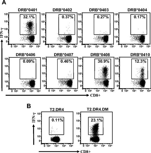 Figure 2. Cross-recognition of HLA DR4 alloantigen by TRAT-specific T cells. (A) EBV-transformed LCLs expressing different HLA DR4 subtypes were used as APCs. After incubation these T cells were then analyzed for IFN-γ expression by the use of ICS assays. (B) TRAT-specific T cells were exposed to T2 cells expressing HLA DRB*0401 with or without peptide editor HLA DM and then assessed for IFN-γ expression by use of the ICS assay.