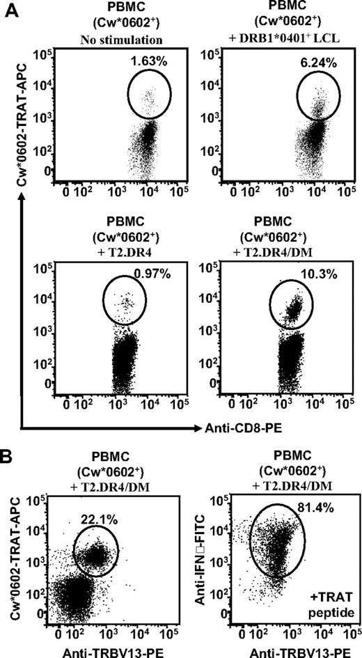 Figure 5. Stimulation of PBMCs with LCLs expressing HLA DR4 allotype rapidly expands TRAT-specific TRBV13+ CD8+ T cells. (A) PBMCs from HLA Cw*0602+ persons were stimulated with either HLA DRB1*0401+ LCL, T2.DR4, or T2.DR4/DM cells and then cultured for 7 days. After incubation these cells were assessed for expansion of TRAT-specific T cells (by the use of HLA-peptide tetramers) and IFN-γ expression by the use of ICS assays. PBMCs stimulated with DRB1*0401+ LCL or T2.DR4/DM cells showed strong expansion of TRAT-specific T cells. (B) T cells expanded after stimulation with T2.DR4/DM were costained with HLA-peptide tetramers and anti-TRBV13 antibodies. Representative data from 1 of the 3 unrelated donors are presented.