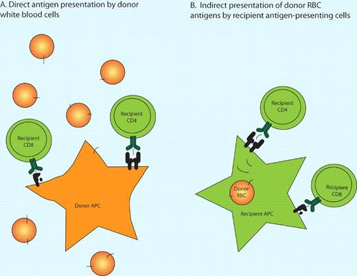 Two mechanisms of alloimmunization by RBC transfusions. (A) In the direct pathway of antigen presentation, residual donor leukocytes in the RBC product present endogenous minor histocompatibility antigens to recipient T cells. (B) In the indirect pathway, recipient antigen-presenting cells take up donor RBCs that express minor histocompatibility antigens and process and present these donor epitopes to recipient T cells. Cross-presentation permits exogenous epitopes to be presented in the context of class I MHC antigens.