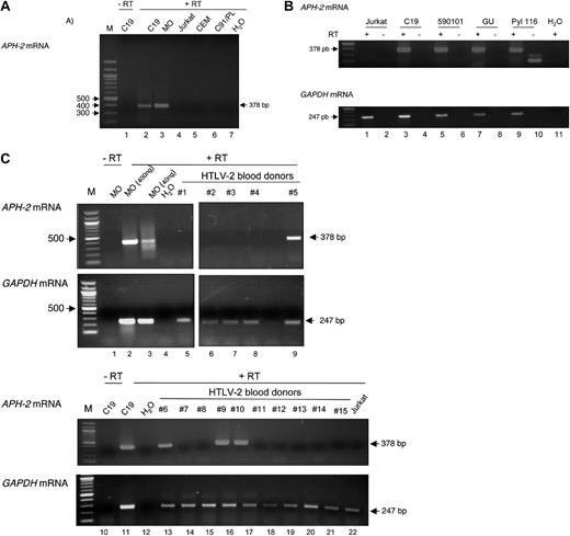 Figure 2. The spliced APH-2 mRNA is detected in HTLV-2–infected cell lines and in PBMCs from HTLV-2–infected patients. (A) Total RNA was extracted from C19 and MO (HTLV-2–infected), Jurkat, and CEM (HTLV noninfected) and C91/PL (HTLV-1–infected) cell lines. RT was performed using the 24-2 primer and was followed by a seminested PCR using the 19-1/21-2 and 22-1/21-2 primers. Lanes 1 and 2 represent C19; lane 3, MO; lane 4, Jurkat; lane 5, CEM; lane 6, C91/PL; lane 7, H2O. (B) Same experimental conditions as in panel A. Lanes 1 and 2 represent RNA extract from Jurkat cells; lanes 3 and 4, from C19 cells; lanes 5 and 6, from 590101; lanes 7 and 8, from GU; lanes 9 and 10, from Pyl116; lane 11, H2O. (C) Same experimental conditions as in panel A. Lanes 2 and 3 represent 400 ng and 40 ng, respectively, of RNA extracted from MO cells used for RT-PCR analysis; lanes 4 and 12, H2O; lanes 10 and 11, RNA extract from C19 cells; lane 22, RNA extract from Jurkat cells; lanes 5 to 9 and 13 to 21, RNAs extracted from PBMC of 15 HTLV-2–infected persons. (Bottom of both panels) The same samples were analyzed for the presence of GAPDH mRNA by RT-PCR. In panel A (lane 1), panel B (lanes 2, 4, 6, 8, and 10), and panel C (lanes 1 and 10), RT was omitted during the RT step. M indicates 100-bp marker. The 2 parts of the image shown in panel C (top panel) are from the same gel.