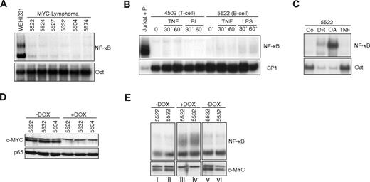 Figure 1. NF-κB activity is impaired in the MYC-transformed cells. (A) NF-κB EMSA using nuclear extracts of different murine lymphoma cells. WEHI231 cells show constitutive NF-κB activity and were used as control. Oct1 DNA binding served as a control for the integrity of the nuclear extracts. (B) EMSA using protein extracts from lymphoma cells treated with the standard NF-κB inducers TNFα (40 ng/mL), PMA (5 ng/mL) and ionomycin (1 μg/mL), or LPS (1 μg/mL) for the indicated time points. Jurkat cells treated with PMA/ionomycin for 1 hour were used as control for NF-κB binding. Sp1 DNA was used as a control for the integrity of the cell extracts. (C) NF-κB EMSA with nuclear extracts of B-cell lymphoma cell line 5522 treated for 2 hours with daunorubicin (5 μM) or okadaic acid (200 nM). Oct1 was used as control for the integrity of the extracts. (D) Immunoblot with cell extracts of B-cell lymphoma cell lines. Doxycycline treatment abrogates transgenic MYC expression. Cells were treated with doxycycline (2 μg/mL) for 12 hours or were left untreated. Expression of p65 was used as loading control. (E) EMSA using cell extracts of 2 lymphoma cell lines demonstrates induction of NF-κB activity in the absence of MYC expression. Immunoblot shows transient loss of MYC expression after doxycycline treatment. Cells were left untreated (lanes 1-2), pulse treated with doxycycline for 12 hours (lanes 3-4), and again left untreated for the consecutive days (lanes 5-6).