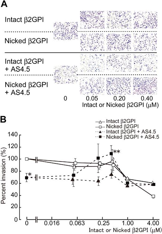 Figure 4. Effect of intact/nicked β2GPI on extravasation of HUVECs using a Matrigel-cell invasion assay in the presence or absence of AS4.5. Effect of intact or nicked β2GPI on the ability of HUVECs to migrate through a basement membrane-like extracellular matrix was evaluated in the presence or absence of AS4.5. HUVECs were added to the top wells of each chamber, and 10% FCS-enriched culture medium was added to each bottom chamber as a source of chemotactic factors. (A) In the top 2 lines of the panels, assays were done without AS4.5. AS4.5 was added to the wells in the bottom 2 lines of the panels. Serial concentrations of intact β2GPI were added in lines 1 and 3, whereas nicked β2GPI was added in lines 2 and 4. Similar results were obtained in other 3 experiments (original magnification, ×100). (B) HUVECs migrated through the Matrigel, and 8-μM pores on the membrane were stained and counted using image processing software. Ratios of the numbers of the HUVECs migrated under treatment with reagents against the number of those cells without any additional reagents were plotted on the graph. Concentrations of intact/nicked β2GPI were as follows: 0.05, 0.2, 0.4, 1.0, or 4.0 μM. Error bars represent SE. Invaded cell counts in the presence of AS4.5 alone (50 nM)* were compared with those in the presence of both AS4.5 (50 nM) and nicked β2GPI (0.4 μM; **P = .027; Student t test).