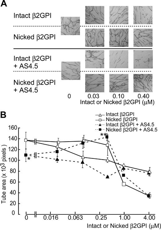 Figure 5. Effect of intact/nicked β2GPI on the VEGF-dependent tube formation of HUVECs cocultured with fibroblasts in the presence or in the absence of AS4.5. VEGF-dependent tube formation of HUVECs cocultured with primary human fibroblasts was evaluated in the presence or absence of AS4.5. (A) HUVECs were visualized by immunostaining with anti–human CD31 antibodies. In the top 2 lines of the panels, the assay was done without AS4.5. AS4.5 was added in the bottom 2 lines of the panels. Serial concentrations of intact β2GPI were added in lines 1 and 3, whereas nicked β2GPI was added in lines 2 and 4. Similar results were obtained in the second and third experiments (original magnification, ×40). (B) Capillary tube formation was quantified using KURABO Angiogenesis Image Analyzer, Version 2. Obtained data (pixels) were plotted onto the graph. Concentrations of intact/nicked β2GPI were as follows: 0.025, 0.1, 0.4, 1.0, or 4.0 μM. Error bars represent SE. Tube areas in the presence of AS4.5 alone (50 nM)* were compared with those in the presence of both AS4.5 (50 nM) and nicked β2GPI (0.4 μM; **P = .044; Student t test).