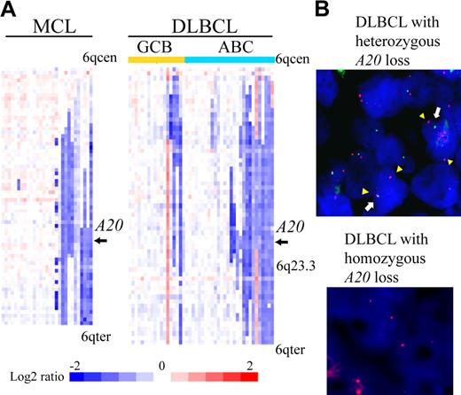 Figure 1. A20 deletion in MCLs and DLBCLs. (A) The heat map represents log2 ratios of bacterial artificial chromosome (BAC)/P-1 phage-derived chromosome (PAC) clones, which are shown in order from chromosome band 6q centromere (6qcen) to 6q telomere (6qter). The genomic profiles of the chromosome band 6q are depicted in 29 cases of MCL and 46 cases of DLBCL. DLBCL cases are divided into 18 cases of GCB and 28 cases of ABC subtypes as defined.12 Relative copy number log2 ratio is displayed according to the color scale. represents the location of A20. (B) Dual-color FISH analysis of DLBCL and MCL cases was performed with a combination of the BAC RP11-356I2 (A20 gene probe) green probe and RP11-277K14 (6q centromere probe) red probe to confirm array CGH results. Representative results of FISH analysis are shown. Two red signals (arrowheads) and one green signal (white arrow) are seen in one cell, indicating heterozygous deletion of the A20 gene, and 2 red signals but no green signal are seen in another cell, indicating homozygous deletion of the A20 gene.