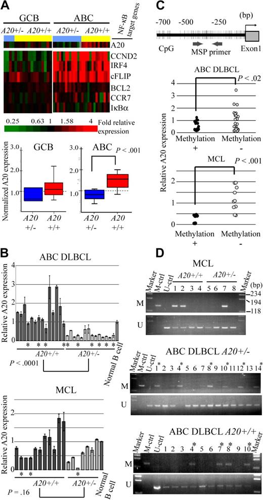 Figure 2. A20 gene inactivation in the genomic subgroups of DLBCL and MCL. (A) Differential A20 expression in the genomic subgroups of DLBCL and MCL. GCB and ABC DLBCL were divided into subgroups with heterozygous A20 deletion and without A20 deletion. (Top panel) Data from DNA microarray analysis of A20 and NF-κB target gene expression in DLBCL clinical samples. Multiples of relative expression are shown according to the color scale. A20+/− indicates the cases in the heterozygous A20 deletion subgroup; A20+/+, the cases in the subgroup without A20 deletion. The NF-κB target gene set used in this study corresponds to Davis et al.19 The box-and-whisker diagrams depicted in the bottom panel represent median expression values and the interquartile range of A20 in the GCB and ABC DLBCL subgroups. Scale bar represents 5 percentile ranges of A20 expression. (B) Real-time RT-PCR analysis of A20 expression in DLBCL and MCL cases. Among ABC DLBCL cases, 14 patients with A20 loss and 14 patients without A20 loss were analyzed, and analysis of 7 patients with A20 loss and 11 patients without A20 loss was performed among MCL cases. Expressions were normalized on the basis of the corresponding β-actin content, and relative expression levels were established by comparing them with those of healthy male activated B-cell control. *Cases with A20 promoter methylation. (C) Correlation between promoter methylation and expression of A20 in DLBCL and MCL. A20 promoter methylation was subjected to MSP analysis. The location of the CpG and MSP primer regions analyzed in this study is shown in the top panel. (Bottom panel) The inverse correlation between A20 promoter methylation and gene expression analyzed by MSP. A20+/− indicates the cases in the heterozygous A20 deletion subgroup; A20+/+, those in the subgroup without A20 deletion. (D) A20 promoter methylation status in DLBCL and MCL tissues. The A20 gene promoter was methylated in colorectal cancer tissues. M denotes the PCR products of the amplified methylated DNA; and U, those of the unmethylated DNA.
