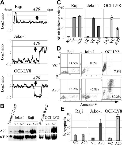 Figure 4. Reintroduction of A20 induces apoptosis in the lymphoma cell lines with A20 deletion. The oncosuppressive effects of A20 on MCL and DLBCL lymphoma cell lines infected with a lentivirus, expressing both A20 and Venus or Venus only as control. (A) Genomic profiles of analyzed lymphoma cell lines. Dots represent the log2 ratios of BAC/PAC clones, which are shown in order from chromosome band 6q centromere to 6q telomere. The location of A20 is indicated with an arrow. (B) Western blot analysis for comparison of A20 expression in human peripheral B cells treated with anti-IgM and in lymphoma cell lines. All cell lines with A20 transduction by a lentiviral vector showed high expression levels for the A20 protein. Infection efficiency of each cell line is shown in supplemental Figure 7. (C) Overexpression of A20 induced repression of NF-κB activity in lymphoma cell lines with A20 deletion as measured with a lentiviral reporter assay. In contrast, NF-κB activity is not affected by overexpression of A20 in Raji. The findings of triplicate experiments are presented as mean ± SD. NC indicates negative control; VC, vector-only control. Effect of A20 overexpression on apoptosis correlates well with NF-κB-inhibiting effect. (D) The findings of representative apoptosis assay measured by annexin V staining. (E) Triplicate experiments are presented as mean ± SD.