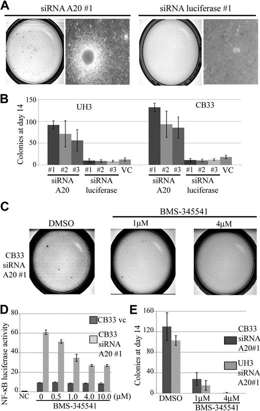 Figure 7. Colony formation assay in methylcellulose-based media of CB33 and UH3 cell lines containing siRNA directed against A20 or firefly luciferase. LCLs were embedded in 0.75% methylcellulose at 104 cells per dish. Each of the siRNAs was lentiviral vector–transduced. The assay was performed 3 times in independent infections, and each assay was performed in triplicate. The insertless vector CSII-H1-pgk-Puro served as vector control (v.c). Three kinds of siRNAs were constructed, each for a different sequence of A20 (siRNA A20 nos. 1, 2, and 3). Three kinds of luciferase siRNA (siRNA luciferase nos. 1, 2, and 3) were also generated as controls. (A) Representative colony assay of CB33. (B) The bar graph depicts the number of colonies 2 weeks after culture. The data represent the mean ± SD. CB33 carrying the A20 knockdown was plated in methylcellulose in the presence of 1 μM and 4 μM of dimethyl sulfoxide (control) or BMS-345541. (C) Representative colony assay. (D) The data represent the mean relative NF-κB luciferase activity normalized against Renilla luciferase activity ± SD after 3-day exposure of BMS-345541 in liquid culture. The experiments were performed in triplicate. NC indicates negative control; and VC, vector-only control. (E) The bar graph represents the number of colonies observed in the methylcellulose assay. Colonies were counted after 2 weeks of culturing. The data represent mean ± SD. Each assay was performed in triplicate.