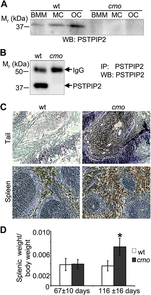 Figure 1. PSTPIP2 deficiency in macrophages, mast cells, and osteoclasts of cmo mice is associated with splenomegaly and increased numbers of macrophages in the spleen and tails of affected cmo mice. (A) Western blots (WB) of whole-cell lysates of bone marrow–derived macrophages (BMM), mast cells (MC), and osteoclasts (OC) obtained from wt and cmo mice probed with an antibody against PSTPIP2. (B) Absence of PSTPIP2 in immunoprecipitates (IP) from cmo BMM. IgG indicates immunoglobulin G. (C) Sections of tails and spleens of cmo mice stained for the macrophage marker F4/80 (brown) and counterstained with hematoxylin (blue) showing extensive macrophage infiltration. (D) Development of splenomegaly in cmo mice more than 13 weeks old. Data ± SD, *P < .01, Student t test; n ≥ 10.