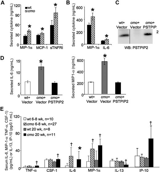 Figure 2. Increased levels of inflammatory mediators are produced by macrophages in cmo mice before the onset of overt disease. (A) Secretion of cytokines and chemokines by cultured BMM from wt and cmo mice (n ≥ 5). (B) LPS-stimulated inflammatory mediator release by BMM of wt and cmo mice (n ≥ 5). (C) Reconstitution of PSTPIP2 expression in cmo macrophages by retroviral transduction. The vertical line indicates a repositioned gel lane from the same blot. (D) Reconstitution of PSTPIP2 expression in immortalized cmo BMM restores normal LPS-stimulated production of IL-6 and MIP-1α. (E) Screening of cytokine and chemokine levels in mouse sera from asymptomatic (6-8 weeks of age, n = 10-27) and diseased (20 weeks of age, n = 8-11) cmo mice and wt control mice. Data ± SD. *P < .05, †P < .01, Student t test. No significant differences in serum levels or BMM secretion were found for the other inflammatory mediators tested (BLC, D30L, Ltaxin, Eotaxin-2, Fas ligand, Fractalkine, G-CSF, GM-CSF, M-CSF, IFN-γ, IL-2, IL-3, IL-4, IL-9, IL-10, IL-12p40p70, IL-12p70, IL-13, IL-17, I-TAC, KC, Leptin, LIX, Lymphotactin, MIG, MIP-1γ, RANTES, SDF-1, TCA-3, TECK, TIMP-1, TIMP-2, sTNFRI, and sTNFRII).
