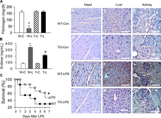 Figure 1. Blockade of endothelial NF-κB signaling attenuated coagulation and improved survival. (A-B) Endothelial NF-κB blockade restored plasma fibrinogen level and reduced plasma D-dimer level. Plasma was collected from WT-Con (W-C), WT-LPS (W-L), TG-Con (T-C), and TG-LPS (T-L) groups of mice at 6 hours after saline or LPS injection. Plasma levels of D-dimer and fibrinogen were determined using commercial kits. Data are mean ± SEM of 6 mice. *P < .001 compared with any other group. #P < .001 compared with the WT-LPS group. (C) Endothelial NF-κB blockade improved survival. WT and TG mice were injected with LPS (5 mg/kg intraperitoneally) and followed for 14 days (no further mortality after 7 days). *P < .001, compared with WT mice (log-rank test, 20 mice per group). (D-O) Endothelial NF-κB blockade reduced tissue fibrin deposition. Paraffin-embedded sections were prepared at 6 hours after saline or LPS injection, dewaxed, rehydrated, blocked, reacted with fibrin/fibrinogen-specific antibody, and counterstained with hematoxylin. The dark brown horseradish peroxidase reaction product shows fibrin deposition in microvasculature and arterioles of heart (J), liver (K), and kidney (L) sections from WT-LPS mice. No fibrin deposition was observed in the 3 organs of WT-Con (D-F) and TG-Con (G-I) mice. The dark brown staining was significantly reduced in tissue sections from TG-LPS (M-O) mice. Bar represents 85 μm. Slides were viewed with an Olympus BH2 microscope (Olympus America) using an Splan 40PL lens at 40×/0.70 and Permount mounting medium (Fisher Scientific). Images were acquired using a Nikon DS camera (model DS-U2 cooled), and were processed with Nikon NIS-Elements basic research software and Adobe Photoshop Version 7.0 software.