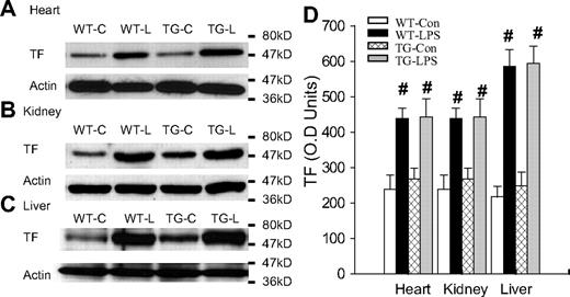 Figure 2. Blockade of endothelial NF-κB signaling had no effects on tissue levels of TF. (A-C) Western blot photographs showing levels of TF in heart (A), kidney (B), and liver (C) of WT-Con (WT-C), WT-LPS (WT-L), TG-Con (TG-C), and TG-LPS (TG-L) mice at 6 hours after saline or LPS injection. Actin indicates membrane for TF blotting was reblotted with actin antibody. (D) Densitometry quantification of TF bands. Compared with WT-Con and TG-Con, WT-LPS and TG-LPS mice showed significantly increased tissue levels of TF in all 3 organs. Data are mean ± SEM of 5 mice. #P < .01 compared with the WT-Con and TG-Con groups.