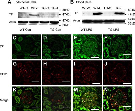 Figure 3. Endothelial NF-κB blockade inhibited endothelial TF expression. (A-B) Endothelial NF-κB blockade diminished TNF-α–induced TF protein in ECs (A), but not LPS-induced TF protein in white blood cells (B). WT and TG ECs were treated with Dox (0.5 μg/mL) for 48 hours and then left untreated (WT-C and TG-C) or stimulated with TNF-α (100 ng/mL) for 6 hours (WT-T and TG-T). White blood cells were isolated from WT-Con (WT-C), WT-LPS (WT-L), TG-Con (TG-C), and TG-LPS (TG-L) mice at 6 hours after saline or LPS injection. TF band was not detected in proteins from control cells but induced in TNF-α–stimulated ECs (WT-T) or LPS-stimulated blood cells (WT-L). The TNF-α–induced TF band was prevented in TG ECs (TG-T). The LPS-induced TF band was not affected in TG white blood cells (TG-L). Blots are representative of 3 independent experiments. Actin indicates membrane for TF blotting was reblotted with actin antibody. (C-N) Representative immunofluorescence staining showing endothelial TF expression. Cryosections of kidney were prepared from mice at 6 hours after LPS injection and stained with anti-TF antibody (green) and anti-CD31 (an endothelial-specific marker) antibody (red). Positive staining for TF (E-F) was detected on sections from WT-LPS and TG-LPS mice. TF and CD31 double-positive staining (yellow) localizes TF-expressing ECs (M). TF-expressing ECs (yellow) were not detected in sections from WT-Con and TG-Con mice (K-L), increased in section from WT-LPS mice (M), and significantly reduced on section from TG-LPS mice (N). Bar represents 50 μm. Data are representative of 3 independent experiments. Slides were viewed with a confocal laser-scanning microscope system (FluoView 300-IX; Olympus) using a PLAN APO 60×/1.4 oil objective lens and VECTASHIELD Mounting Medium (Vector Laboratories). Images were processed and analyzed using Image J with colocalization plug-ins that statistically evaluate colocalization using Pearson correlation coefficient (r), which varies from −1 to 1, where 1 equals complete colocalization.