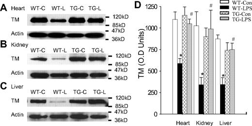 Figure 5. Blockade of endothelial NF-κB signaling prevented LPS-induced TM down-regulation. (A-C) Western blot photographs showing levels of TM protein in heart (A), kidney (B), and liver (C) of WT-Con (WT-C), WT-LPS (WT-L), TG-Con (TG-C), and TG-LPS (TG-L) mice. Actin indicates membrane for TM blotting was reblotted with actin antibody. (D) Densitometry quantification of TM bands. Tissue level of TM protein was high in all 3 organs of WT-Con and TG-Con mice, greatly reduced in organs of WT-LPS mice, and restored in the 3 organs of TG-LPS mice. Data are mean ± SEM of 6 to 8 mice. *P < .001 compared with any other group. #P < .02 compared with the WT-LPS group.