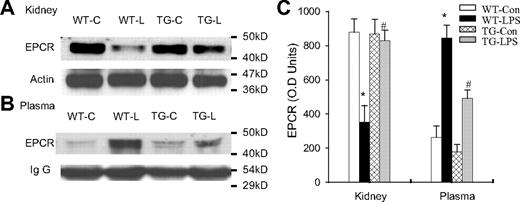 Figure 6. Blockade of endothelial NF-κB signaling reduced endothelial EPCR shedding. (A-B) Western blot photographs comparing tissue (A, kidney) and plasma (B) levels of EPCR protein in same groups of WT-Con (WT-C), WT-LPS (WT-L), TG-Con (TG-C), and TG-LPS (TG-L) mice. Actin and IgG indicate membrane for EPCR blotting was reblotted with actin or IgG antibody. (C) Densitometry quantification of EPCR bands. Compared with WT-Con and TG-Con mice, WT-LPS mice showed a markedly reduced tissue level of EPCR, in parallel with a significantly elevated plasma level of EPCR, indicating EPCR shedding. TG-LPS mice abrogated the LPS-induced reduction in tissue EPCR level and elevation in plasma EPCR level. Data are mean ± SEM of 5 mice. *P < .001 compared with any other group. #P < .001 compared with the WT-LPS group.