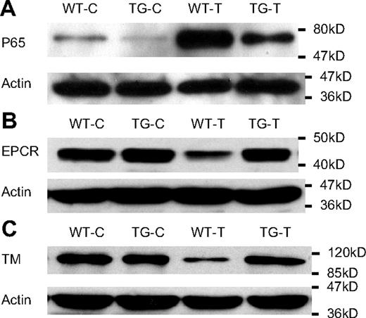 Figure 7. NF-κB activation resulted in reduced cellular levels of EPCR and TM in cultured ECs. WT and TG ECs were incubated with Dox (0.5 μg/mL) for 48 hours to induce I-κBαmt expression in TG ECs, and left untreated (WT-C and TG-C) or stimulated with 100 ng/mL TNF-α (WT-T and TG-T) for 1 (for measuring NF-κB activity) or 14 hours (for detecting EPCR and TM proteins). Bolts are representative of 3 experiments. (A) Representative Western blot photograph showing NF-κB activation measured by p65 nuclear translocation. TNF-α markedly activated NF-κB in WT ECs (WT-T), which was significantly inhibited in TG ECs (TG-T). (B) Representative Western blot photograph showing that TNF-α stimulation decreased cellular level of EPCR protein in WT ECs (WT-T), but not in TG ECs (TG-T). (C) Representative Western blot photograph showing that TNF-α stimulation decreased cellular level of TM protein in WT ECs (WT-T), but not in TG ECs (TG-T). Actin indicates membrane for p65, EPCR, or TM blotting was reblotted with actin antibody.