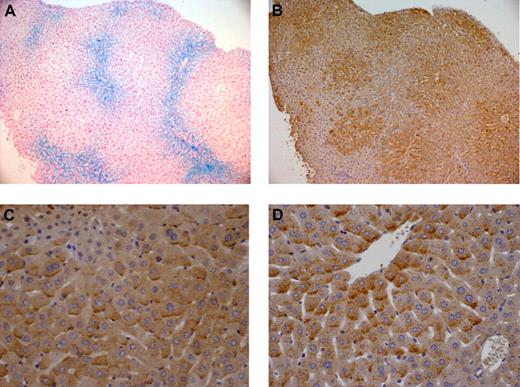 Figure 2. Cellular localization of BMP6 in hepatic iron overload. BMP6 expression was detected by immunohistochemistry in (B-C) wild-type B6 mice with secondary iron overload and (D) Hfe-deficient D2 mice. These mice have similar degrees of iron loading. As seen in serial liver sections, whereas iron deposits visualized by Perls staining (A) are predominantly periportal, BMP6 staining is mostly centrilobular (B). Mutant animals and mice with secondary iron overload have intense staining at the basolateral membrane domain of hepatocytes (C-D). Original magnification, ×100 (A-B) or ×400 (C-D). Images were captured using a Leica DMR microscope equipped with an HC PL Fluotar 10×/1 (A-B) or 40×/1 (C-D) numeric aperture objective lens and a Leica DFC 300 Fx camera. They were processed using Leica IM50 image acquisition software.