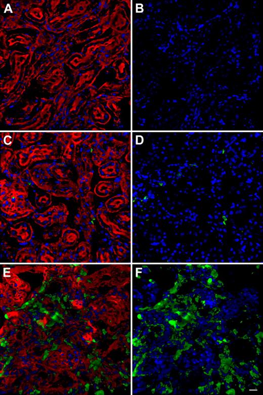 Figure 1. Representative images of Z-series confocal microscopy of kidneys. Transplanted, BMC-derived, GFP-positive cells are seen in green. (A,C,E) F-actin intermediate filament staining by Bodipy-phalloidin (red) and nuclei staining by DAPI (blue). (B,D,F) Same picture without Bodipy-phalloidin to better observe the GFP-positive cells. (A-B) Kidney section of Ctns−/− mice treated with Ctns−/− BMC; no GFP-positive cells are observed establishing the threshold for GFP detection. These instrument settings were saved and used for all the subsequent imaging.(C-D) Representative kidney section of WT mice transplanted with GFP BMCs. Few GFP-positive cells are observed. (E-F) Kidney section of Ctns−/− mice transplanted with GFP BMCs. Abundant GFP-positive BMC-derived cells are evident. Scale bar represents 20 μm (40×/1.3 NA oil objective).