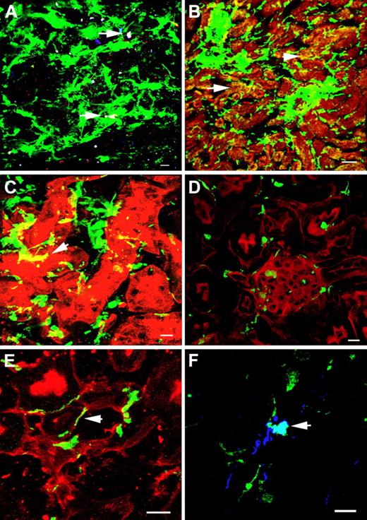 Figure 2. Representative Z-series confocal microscopy pictures of WT BMC-treated kidneys to demonstrate cell phenotypes. Transplanted, BMC-derived, GFP-positive cells are seen in green. (A) F4/80-positive macrophages are stained in blue, and CD45-positive leukocyte lineage cells are stained in red. Few GFP-positive cells are macrophages (white, arrows). (B) Distal tubular staining by D biflorus agglutinin (red). Some GFP-positive cells are colocalized with distal tubular cells (yellow, arrows). (C) Proximal tubular staining by Lotus tetragonolobus lectin (red). Some GFP-positive cells are colocalized with proximal tubular cells (yellow, arrow). (D) F-actin intermediate filament staining by Bodipy-phalloidin (red). Some GFP-positive cells are found in the glomeruli. (E) Tubular basement membrane staining by Ricinus communis agglutinin I (red). Some GFP-positive cells colocalize with the basal membranes (arrow). (F) Endothelial cell staining with anti-VWF antibody (blue). Some GFP-positive cells are colocalized with endothelial cells (white, arrow). Scale bars represent 10 μm (60×/1.4 NA oil objective), except for panel B, in which scale bar represents 50 μm (20×/0.75 NA air objective).
