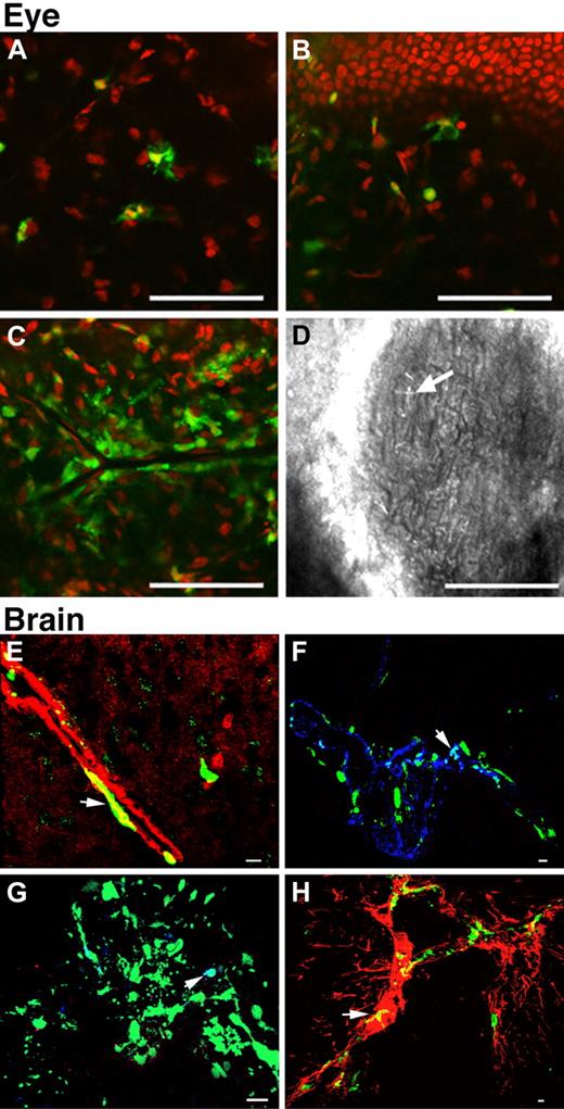 Figure 3. Representative Z-series confocal microscopy pictures of the eyes and brains of mice treated with WT BMCs. Transplanted, BMC-derived, GFP-positive cells are seen in green. (A-D) Eye. Bodipy-phalloidin is seen in red. Scale bars represent 50 μm (24×/0.6 NA air objective). GFP-positive cells were observed in the corneal stroma (A) and adjacent to the basal cells of the corneal epithelium (B). Heavy perivascular infiltrates around the limbus were also observed (C). Corneal cystine crystals (D, arrow). (E-H) Brain. Scale bars represent 10 μm (E: 60×/1.4 NA oil objective; F-H: 40×/1.3 NA oil objective). The majority of the GFP-positive cells were observed in association with blood vessels. Small round cells were observed in the lumen, many appearing to be attached to the endothelium. Large flat cells were either fused with or differentiated into smooth muscle cells colocalizing with F-actin seen in red (E, yellow, arrow) or endothelial cells colocalizing with VWF seen in blue (F, white, arrow). A few GFP-positive cells were macrophages (G, white, arrow). Some were glial cells colocalizing with glial fibrillary acidic protein staining seen in red (H, yellow, arrow).