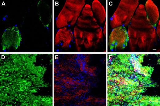 Figure 4. Representative Z-series confocal microscopy pictures of the muscle and spleen of mice treated with WT BMCs. Transplanted, BMC-derived, GFP-positive cells are seen in green (A,D). F-actin intermediate filament staining by Bodipy-phalloidin is seen in red (B,E), and colocalization of both stains is shown in the last panels (C,F). Muscle (A-C). Nuclei stained by DAPI are blue. Some GFP-positive cells are interstitial, and some are differentiated or fused with muscle fibers as shown by the colocalization of GFP-positive with muscle fibers (C). Spleen (D-F). Most of the GFP-positive cells in the spleen are part of the reticuloendothelium as determined by colocalization with VWF (blue) and F-actin staining (F). Scale bars represent 10 μm (A-C: 60×/1.4 NA oil objective; D-F: 40×/1.3 NA oil objective).