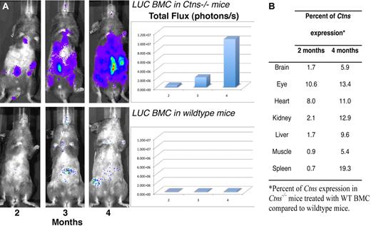 Figure 6. In vivo luciferase imaging and quantitative Ctns expression in Ctns−/− mice treated with WT BMCs as a function of time. (A) BMCs isolated from luciferase transgenic mice were transplanted into lethally irradiated Ctns−/− mice (top panel) and WT mice (bottom panel). These are representative pictures taken in live animals with the IVIS imaging system after luciferin injection at 2, 3, and 4 months. The luminescence signal intensities were quantified and are represented in the matching histograms. (B) Percentage of Ctns expression in Ctns−/− mice treated with WT BMCs compared with WT mice. The results represent the number of Ctns gene copies determined by quantitative RT-PCR as a ratio of the results shown in Table 3 for BMC-treated Ctns−/− mice divided by the results for WT control mice.