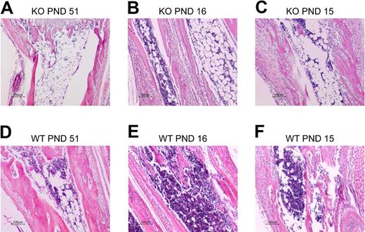 Figure 5. Histologic analysis of bone marrow in Zfp36l2 KO and WT mice. Tissue sections from the radius/ulna of PND 51 KO (A) and WT (D) mice, PND 16 KO (B) and WT (E) mice, and PND 15 KO (C) and WT (F) littermate pairs of mice were stained with hematoxylin and eosin. Note the hypocellular bone marrow along with an increased number of adipocytes in the KO samples. Original magnifications ×10, obtained with a Nikon Eclipse E600 microscope with a Nikon DXM1200 digital camera. Images were imported into the Nikon Act-1 software.