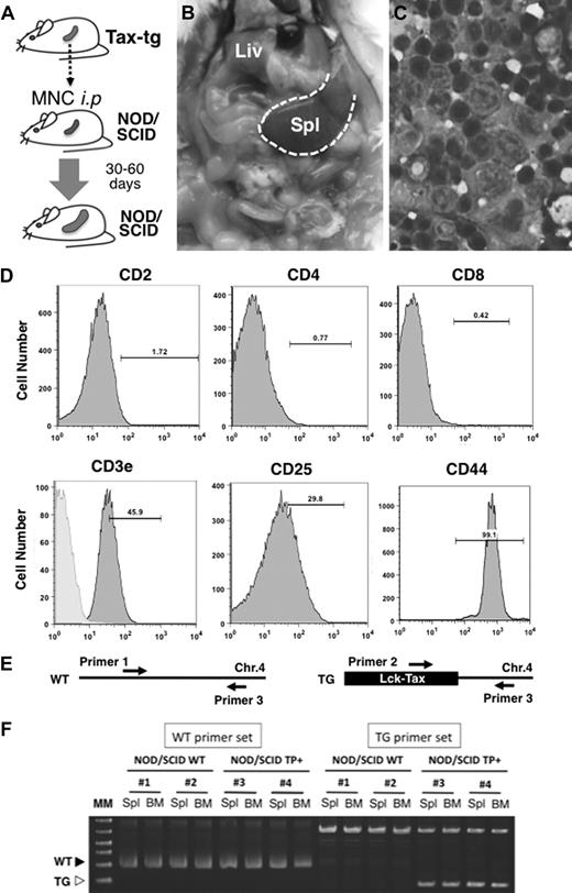 Figure 1. Transplantation of Tax-Tg mouse-derived splenic mononuclear cells to NOD/SCID mice. (A) Experimental design of the transplantation assay. (B) Remarkable splenomegaly was observed in the lymphoma-reconstituted NOD/SCID mouse. Spl indicates spleen; and Liv, liver. The dotted line shows the outline of the enlarged spleen. (C) Cytospin analysis of spleen cells isolated from reconstituted lymphoma in the NOD/SCID mouse. The spleen was filled with ATL-like lymphomatous cells. (D) Surface marker analysis of lymphomatous cells from spleen. These had the identical phenotype of lymphomatous cell reconstituted by Tax-Tg–derived splenic mononuclear cells: CD2−, CD4−, CD8−, cytoplasmic CD3+, and surface CD25+ and CD44+. (E) Schematic representation of the PCR assay to identify and confirm the Tax transgenic integration site. Lck-Tax transgenes were tandemly inserted on the chromosome 4 (Chr.4) in the original transgenic animals. (F) Genotyping of mononuclear cells in the spleen and BM. WT PCR product (300 bp) was detected in both the normal and CSC-transplanted NOD/SCID spleen and BM. However, Tax-Tg (TG) PCR products identifying the expected integration site of the transgene (200 bp) were detected only in the reconstituted ATL-like lymphomatous cells in spleen and BM. TP+ indicates transplantation.