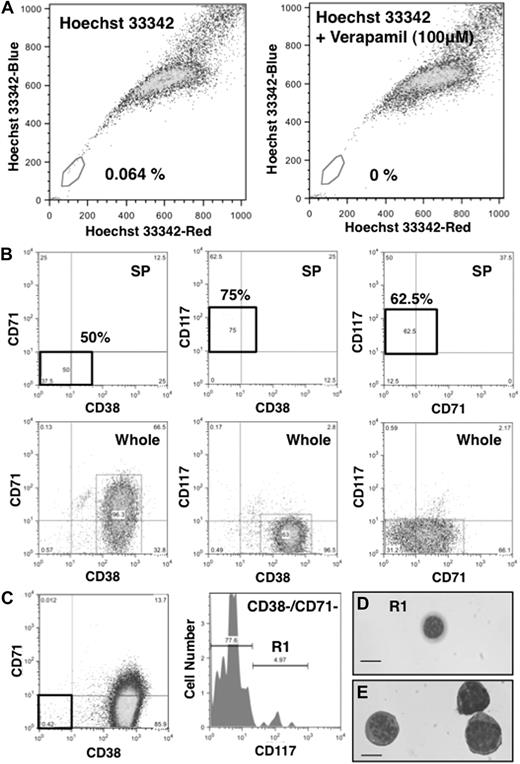 Figure 3. Functional analysis in the NOD/SCID repopulating ATL-like lymphoma cells. (A) SP cell analysis in the NOD/SCID repopulating ATL-like lymphoma cells. The SP regions are indicated by a trapezoid on each panel. (Left panel) Approximately 0.064% of SP cells were observed in the SLCs. (Right panel) SP cell analysis after treatment with verapamil (100 μM), where the SP fraction was lost. (B) Triple-staining analysis of CD38, CD71, and CD117 in the SP fraction. More than 50% of CD38−/CD71−/CD117+ corresponded to the SP fraction. (C) FACS CD38−/CD71−/CD117+ and CD38−/CD71−/CD117− cells. (D) Cytospin analysis of the CSC candidate (CD38−/CD71−/CD117+) and (E) non-CSC candidate (CD38+/CD71+/CD117−) populations.