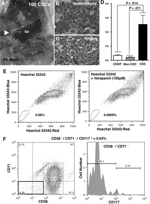 Figure 4. Regenerative potential of ATL-like lymphoma in 102 CSCs. ATL-like lymphoma-regenerative activity was assessed by the transplantation of 102 CSCs, the non-CSC fraction, and SLCs. (A) ATL-like lymphoma was regenerated by the transplantation of 102 CSCs into the NOD/SCID mouse at 60 days. (B) Marked splenomegaly was observed in the NOD/SCID recipient mice. (C) Ascites was also observed in the NOD/SCID recipient mice. (D) Total spleen weight was significantly increased only in the CSC-transplanted NOD/SCID mouse. (E) SP analysis of ATL-like lymphoma cells generated by the transplantation of 102 CSCs. (Left panel) The SP fraction (total = 0.066%) was present after CSC transplantation. (Right panel) The SP fraction was lost in the dot plot with treatment by 100 μM verapamil. (F) Surface marker analysis in the lymphoma cells regenerated by the 102 CSC transplantation. The CSC candidate cells (CD38−/CD71−/CD117+) were also regenerated after transplantation of 102 CSCs.