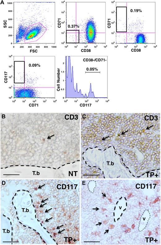 Figure 6. Flow cytometric analysis of lymphomatous cells in the NOD/SCID BM. NOD/SCID repopulating lymphomatous cells were isolated from BM. (A) Triple staining analysis with CD38, CD71, and CD117 in the BM SLCs. As was observed in spleen, the CSC candidates were also observed in the BM. (B) Histologic analysis of ATL-like lymphomatous cells in the NOD/SCID BM. In the normal NOD/SCID BM, CD3+ cells were a rare population (). (C) In the reconstituted NOD/SCID mouse BM, CD3+ cells were readily identified (arrow). (D) CD117+ cells as a surrogate CSC marker could be detected in the osteoblastic niche of the trabecular bone (arrow). (E) In the medullary region, CD117+ cells (CSCs) were also detected in the vascular niche (). T.b. indicates endosteal region in the trabecular bone; V, vascular zone; TP+, transplantation; and NT, no transplantation. Scale bar represents 20 μm.