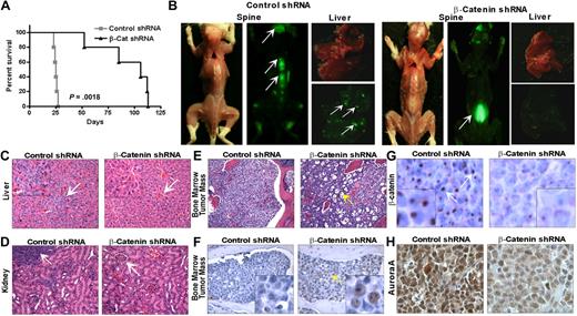 Figure 5. β-catenin knockdown improves survival in a xenograft mouse model of MM. β-catenin knockdown improves survival in Kaplan-Meier survival curves (A) by decreasing tumor load and metastasis (B). Mice injected with control or β-catenin shRNA-GFP MM1.S cells were analyzed by whole-body imaging. Note decreased tumor GFP nodule number in the spine and liver of β-catenin shRNA mice compared with control mice (white arrows). Histologic and IHC analysis of tumors showed decreased tumor metastasis in the liver (C) and kidney (D), increased numbers of tingible body macrophages (E), and increased TUNEL staining (F), as well as decreased expression of β-catenin (G) and AurKA (H) in engrafted β-catenin shRNA MM1.S cells compared with control MM1.S xenografts. Hematoxylin & eosin stains (panels C, D, and E); IHC stains (panels G and H).