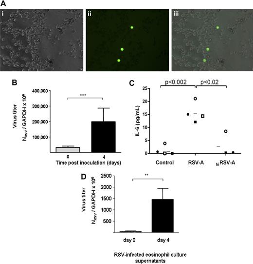 Figure 5. Respiratory syncytial virus replicates in human eosinophils. (A) Green fluorescent protein detected in eosinophils after challenge with rgRSV. Shown are (i) phase contrast, (ii) fluorescent, and (iii) composite of panels i and ii, showing expression of green protein in eosinophils. Photographed with 32× objective in 6-well culture dish in media. (B) Replication of RSV in human eosinophils. Cells were challenged with respiratory syncytial virus (RSV; MOI = 1) for 2 hours, washed, and resuspended, and total RNA was isolated immediately (day 0) or 4 days later for determination of virus copy number. Results are pooled data from 3 separate experiments, ***P < .001. (C) IL-6 is released by RSV-infected eosinophils. Detection of IL-6 by multiplex bead assay in culture supernatants from unchallenged (control), RSV-infected, and hiRSV-challenged eosinophils. Each symbol represents an independent eosinophil donor; n = 3 to 4; *P < .02 and **P < .002. (D) Infectious virions are released from RSV-infected human eosinophils. Supernatants from human eosinophil cultures at 0 or 4 days after inoculation were used to challenge cells of the HEp-2 line, which is highly permissive for RSV replication. Total RNA from the HEp-2 cells was harvested at 7 days after inoculation, and Q-RT-PCR was performed to determine virus copy number. Results shown are a single experiment performed in triplicate, *P < .01. Data shown represent mean ± SEM.