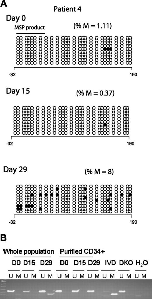 Figure 3. p15INK4B promoter methylation in a complete responder (patient 4). (A) Genomic DNA BSS of 10 clones at 3 different time points (days 0, 15, and 29) during the first cycle of treatment for patient 4. The numbers below the horizontal bar describe the position of the CpGs relative to the transcription start site (+1). Notations as per Figure 2. (B) MSP gel for the DNA from CD34− and enriched CD34+ cells at 3 different time points day 0 (d0), days 15 to 16 (d15), and days 28 to 29 (d29) of therapy. U indicates unmethylated lane; and M, methylated lane. In vitro methylated (IVD) DNA was used as a positive control for methylated status, HCT 116 double knockout (DKO) for DNMT1 and DNMT3b was used as a positive control for unmethylated status, and water (H2O) was used as a negative control for the PCR reaction.