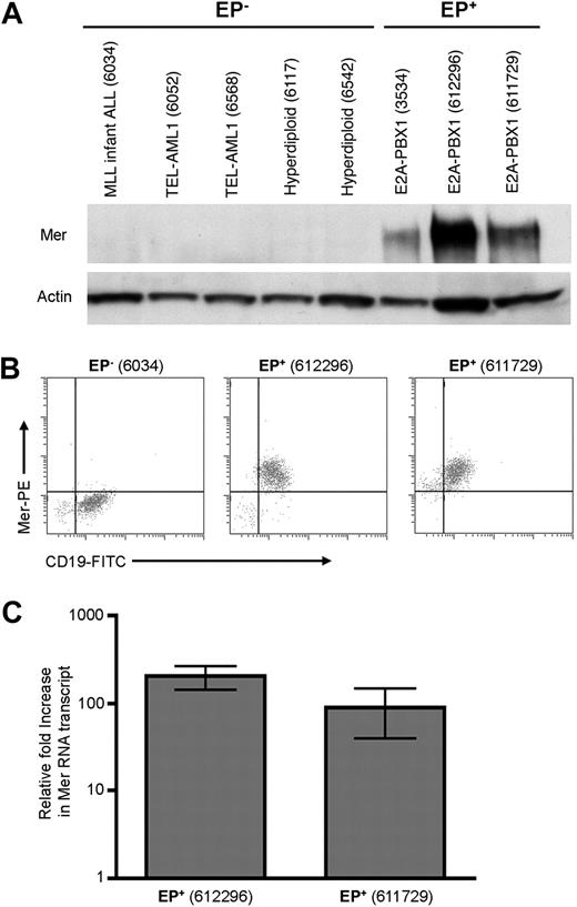 Figure 1. Mer is expressed in diagnostic samples derived from patients with E2A-PBX1+ B-ALL. Twenty-eight diagnostic bone marrow samples from patients with B-cell ALL were analyzed by Western blot (A) and/or flow cytometry (B) for the expression of Mer protein. A subset of these samples was also analyzed by quantitative real-time RT-PCR (C) for the presence of Mer mRNA transcript. (A) Western blot analysis of Mer protein (∼ 180 kDa) in representative samples of non–E2A-PBX1 (EP−) B-ALL (lanes 1-5) and E2A-PBX1+ (EP+) B-ALL (lanes 6-8). Patient sample ID is shown in parentheses for comparison to the complete dataset listed in supplemental Table 1. The membrane was stripped and reprobed with anti-Actin (∼ 43 kDa) antibody to confirm similar loading of total protein. (B) Representative flow cytometry profiles for 1 EP− B-ALL sample (6034) and 2 EP+ B-ALL samples (612296 and 611729) are shown. All 3 samples expressed the CD19 B-lineage marker, whereas only the EP+ samples exhibited Mer staining. (C) Quantitative real time RT-PCR for 2 representative EP+ B-ALL samples exhibiting 100- to 200-fold increase in Mer transcript relative to the mean expression in 5 EP− B-ALL samples which express negligible amounts of Mer mRNA. Mean values and standard errors were derived from 3 independent experiments performed in duplicate.