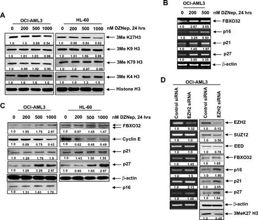 Figure 3. DZNep treatment depletes trimethylation of K27 on histone H3 and induces the expression of cell-cycle regulatory genes p16, p21, and p27, as well as the cell death regulator FBXO32 in AML cells. (A) OCI-AML3 and HL-60 cells were treated with the indicated concentrations of DZNep for 24 hours. After this, nuclear extracts were prepared and immunoblot analysis was performed for 3MeK27 histone H3, 3MeK9 histone H3, 3MeK79 histone H3, and 3MeK4 histone H3. The expression levels of histone H3 in the extracts served as the loading control. (B) OCI-AML3 cells were treated with the indicated concentrations of DZNep for 24 hours. After treatment, total RNA was isolated and RT-PCR was performed for FBXO32, p16, p21, and p27. A β-actin–specific reaction and expression levels served to ensure equal loading. (C) OCI-AML3 and HL-60 cells were treated with the indicated concentrations of DZNep for 24 hours. After this, total cell lysates were prepared and immunoblot analysis was performed for FBXO32, cyclin E, p16, p21, and p27. The expression levels of β-actin in the lysates served as the loading control. (D) OCI-AML3 cells were transfected with scrambled control or EZH2 siRNA for 48 hours. Then, total RNA was isolated and RT-PCR was performed for EZH2, SUZ12, EED, FBXO32, p16, p21, and p27. A β-actin–specific reaction and expression levels served to ensure equal loading. Alternatively, total cell lysates were prepared and immunoblot analysis was performed for EZH2, SUZ12, EED, FBXO32, p16, p21, p27, and 3MeK27 histone H3. The expression level of β-actin in the lysates served as the loading control.