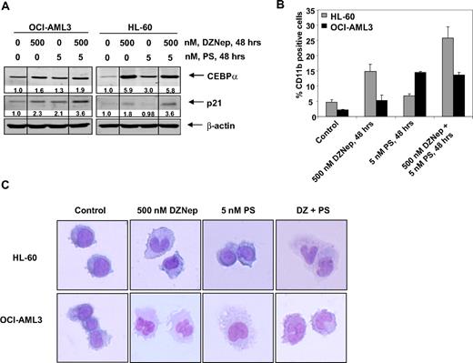 Figure 6. Treatment with DZNep and/or PS induces differentiation of AML cells. (A) Immunoblot analysis of HL-60 and OCI-AML3 cells treated for 48 hours with the indicated concentrations of DZNep and/or PS. The expression levels of β-actin in the lysates served as the loading control. Vertical lines have been inserted to indicate repositioned gel lanes. (B) HL-60 and OCI-AML3 cells were treated with the indicated concentrations of DZNep and/or PS for 48 hours. After this, cells were washed and stained with CD11b antibody, and the percentages of CD11b+ cells were determined by flow cytometry. (C) HL-60 and OCI-AML3 cells were treated with the indicated concentrations of DZNep and/or PS for 72 hours. After treatment, the cells were cytospun onto glass slides, Wright stained, and observed with a microscope to assess cellular morphology.