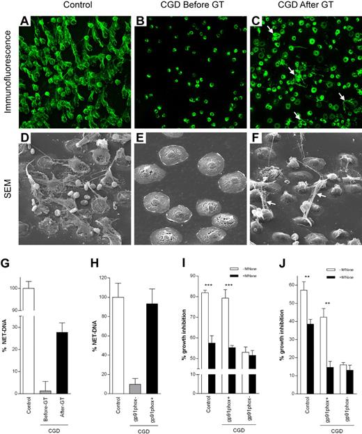 Figure 2. NET formation and inhibition of A nidulans growth. Control (A,D), but not CGD (B,E), neutrophils made NETs on 3-hour PMA stimulation. For immunofluorescence, NETs were stained with an antibody that recognizes neutrophil elastase (green; A-C). NETs were clearly visible also by scanning electron microscopy (SEM; D-F). Neutrophils isolated from the CGD patient before GT could be activated because they flattened out (E) but did not make NETs. The ability to form NETs was partially restored by GT 6 weeks after GT (C,F white arrows). (G) Quantification of NET-DNA released after 3 hours of PMA stimulation of control neutrophils, CGD neutrophils before and 6 weeks after GT or (H) after stimulation of CGD gp91phox+ and CGD gp91phox− FACS-sorted neutrophils. CGD gp91phox+ neutrophils showed normal NET formation, whereas CGD gp91phox− neutrophils showed only residual NET formation. FACS-sorting efficiency was 90% to 92% for CGD gp91phox− and 95% to 96% for CGD gp91phox+ cells. (I-J) NET inhibition of A nidulans conidia and hyphae. (I) Conidia were plated on FACS-sorted neutrophils prestimulated with PMA plus or minus MNAse (ie, when NET formation was complete, cells were dead and therefore incapable of phagocytosis). Hyphal outgrowth was measured after 16 hours. (J) Hyphae were coincubated with FACS-sorted neutrophils, and PMA plus or minus MNAse and hyphal viability was assessed after 5 hours. (G-J) Data are mean ± SD of a representative triplicate experiment. Inhibition of fungal growth is expressed as percentage of control values (A nidulans conidia or hyphae incubated in media). The differences between −MNase and +MNase were significant (for control and CGD gp91phox+ cells) by Student t test: **P < .01; ***P < .001.