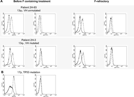 Figure 3. Functional assessment of p21/p53 induction after DNA damage may be normal in cases with F-refractory disease without the 17p deletion or TP53 mutation. (A) Normal p21 and p53 induction before and after development of F-refractory disease in CLL cells without the 17p deletion or TP53 mutation. The pattern of p21 and p53 expression/induction did not change with the occurrence of F-refractory disease: black represents expression without 5 Gy irradiation; gray, expression after 5 Gy irradiation. Both samples show a low baseline level and normal up-regulation of p21 and p53 after irradiation. (B) For comparison, an example of type A defect with high baseline p53 levels caused by a mutation of TP53. After induction of DNA damage, p21 is not up-regulated.