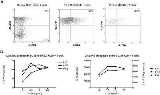 Figure 3. IL-17RB (IL-25 receptor) and cytokine expression by L-HES CD3−CD4+ T cells. (A) Four-color immunofluorescent labeling of control and P3's PBMCs. The lymphocyte populations were gated on CD4 and CD3 positivity/negativity. (B) Purified CD3−CD4+ T cells from P3 were cultured for 48 hours with phorbol ester and anti-CD28 in the absence or presence of increasing concentrations of rhIL-25, and cytokine concentrations were determined using BD Cytometric Bead Array Flex Sets. A representative experiment is shown.
