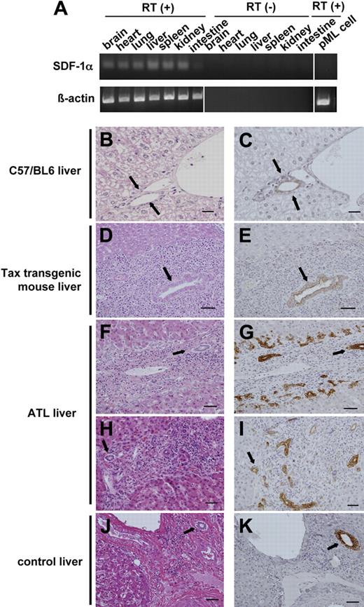 Figure 4. Tissue expression of SDF-1α. (A) The expression levels of SDF-1α transcripts in various tissues of C57BL/6 mice, including brain, heart, lung, liver, spleen, kidney, and intestine with or without reverse transcriptase (RT) reaction. In the lane at the right, the expression level of SDF-1α transcripts in pML cells was also examined. β-Actin was used as an internal control. Vertical lines have been inserted to indicate a repositioned gel lane. (B-K) Immunohistochemical analysis of SDF-1α protein. H&E staining (B,D) and immunostaining (C,E) of SDF-1α in bile ducts from a normal C57BL/6 mouse (B-C) and in a bile duct surrounded by infiltrating tumor cells from a HTLV-I Tax transgenic mouse (D-E). Black arrows indicate the same bile duct in serial sections for panels B and C and panels D and E. Bars indicate (B-C) 20 μm or (D-E) 50 μm. Immunohistochemical analysis of SDF-1α protein in liver bile ducts from ATL patients (F-I) and a patient without ATL (J-K). Serial sections of H&E-stained liver from ATL patients (F,H) were examined with immunostaining using anti–SDF-1α antibody (G,I). Black arrows indicate the same bile duct in serial sections for panels F and G and panels H and I. Serial sections of (J) H&E-stained liver from a patient without ATL were also analyzed for (K) SDF-1α expression. Black arrows indicate serial sections of the same bile ducts for panels J and K. Bars indicate 50 μm. Brown indicates immunopositive reaction (C,E,G,I,K).