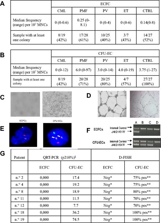 Figure 1. Frequency, morphology, and molecular characterization of ECFCs and CFU-ECs. (A) ECFC yield in patients and controls. In the first row, the median frequency (and range) of ECFCs obtained from patients and controls is reported, whereas the second row represents the proportion of cases in which at least 1 ECFC-derived colony was obtained. Frequency was calculated as: total number of colonies grown multiplied 107 and then divided by the total number of MNCs plated. (B) CFU-EC yield in patients and controls. In the first row, the median frequency (and range) of CFU-ECs obtained from patients and controls is reported, whereas the second row represents the proportion of cases in which at least 1 CFU-EC–derived colony was obtained. Frequency was calculated as: total number of colonies per 5 × 106 MNCs plated. (C) ECFC and CFU-EC colonies. Representative photomicrographs of an ECFCs cultured from peripheral blood MNCs of a PMF patient (left, original magnification ×4) and of a CFU-EC cultured from peripheral blood MNCs of a CML patient (right, original magnification ×5) are shown. Similar colonies were grown from other CMPD patients and controls. (D) ECFC-derived and CFU-EC–derived cell capacity of tube formation in matrigel. ECFC-derived cells (left, original magnification ×2.5) and CFU-EC–derived cells (right, original magnification ×4) from peripheral blood MNCs of patients and controls show different capacity of tube formation in matrigel. (E) FISH from ECFCs and CFU-ECs of a CML patient. ECFCs (left) and CFU-ECs (right) derived cells from a CML patient show, respectively, the lack (2 green and 2 red spots) and the presence (2 fusion signals, arrows) of BCR-ABL fusion gene by FISH reaction. The normal cutoff value used for this probe is 1%, as established in our laboratory using normal controls. (F) JAK2-V617F mutation in ECFC-derived and CFU-EC–derived cells. A seminested PCR was performed, in which the first round amplified a 364-bp product from both mutant and wild-type JAK2 allele and the second round a 203-bp product specific for the JAK2-V617F allele. Amplification products were analyzed by electrophoresis on an ethidium bromide 2% agarose gel. First line represents internal control; second line, JAK2-V617F. (A) Positive control. (B-C) Two representative polycythemia vera patients. (D) Negative control. (G) Quantitative RT-PCR for BCR-ABL fusion gene and FISH results in ECFCs and CFU-ECs from 7 CML patients. For each case, at least 200 nuclei were scored for the presence of the t(9;22)(q34;q11). §p210 values are expressed as a percentage of the ratio of BCR-ABL/ABL. *Two red and 2 green spots, no fusion spot. **Two fusion spots, one red and one green.