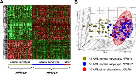 Figure 1. Gene expression profiling analysis of NPM1-mutated AML (NK vs AK). Analysis based on the top-500 differentially expressed genes between AML cases NPM1c− (unmutated NPM1) and NPM1c+ (mutated NPM1). The gene discovery process was restricted to AML with NK (ie, a supervised analysis was performed). (A) Hierarchical clustering heatmap also including 10 NPM1 mutated AML cases with other chromosomal aberrations (other). The similarity of the genes was computed by Euclidean distance, and then Ward method was used to cluster the gene expression profiles based on these measures. The normalized expression value for each probe set is coded by color (standard deviation from mean). Red cells indicate high expression and green cells indicate low expression. (B) Principal component analysis (PCA). The AML samples were plotted in a 3-dimensional space using the 3 principal components (PC) capturing most of the variance in the original dataset (PC1 = 34.0%, PC2 = 7.0%, PC3 = 5.2%). Each patient sample is represented by a single color-coded sphere.