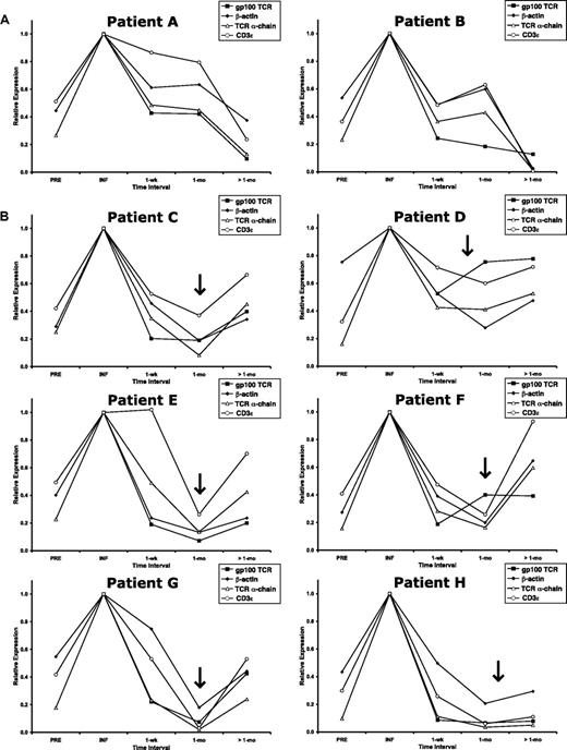 Figure 6. Up-regulation of gene expression in patients after in vivo restimulation. The gp100-specific TCR transgene RNA level was corrected for the DNA level at each time interval and normalized to the infusion values (INF). RNA expression of β-actin, the endogenous TCR α-chain, and CD3ϵ before (PRE) and at time intervals after cell infusion was normalized to the infusion value (INF). (A) Patients A and B from the first cohort of this trial received IL-2 and peptide vaccination on the day of adoptive cell transfer. (B) Patients C through H from the second cohort of this trial received IL-2 with recombinant fowlpox vaccination on the day of adoptive cell transfer, as well as repeat administration of IL-2 with recombinant fowlpox vaccination approximately 1 month after adoptive cell transfer (indicated by ).