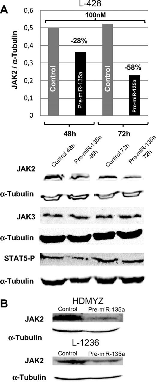 Figure 4. Western blot analysis of JAK2 levels in cHL cells after transfection. (A) JAK2, JAK3, and STAT5 P levels in L-428 cells at 48 and 72 hours after transfection with 100 nM of pre-miRNA versus control cells. JAK3 was used as control for miR-135a specificity. In concordance with decreasing JAK2 levels, a slight decrease in levels of the downstream target phosphorylated STAT5 was observed. (B) Validation of the down-regulation effect produced by miR-135a on JAK2 in HDMYZ and L-1236 cHL cell lines.