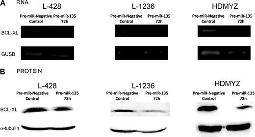 Figure 6. Bcl-xL expression analysis. (A) Reverse-transcribed polymerase chain reaction of Bcl-xL at 72 hours after transfection with 100 nM of pre-miR-135a. A reduction in Bcl-xL mRNA levels can be observed in the pre–miR-135–transfected cells versus the control cells. No change was observed in the β-glucuronidase (GUSB) mRNA levels, used as control. (B) Western blot analysis of Bcl-xL at 72 hours after transfection showed a correlation between BcL-xL mRNA and protein levels.